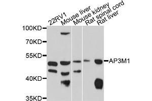 Western blot analysis of extracts of various cell lines, using AP3M1 antibody (ABIN5997242) at 1/1000 dilution. (AP3M1 Antikörper)