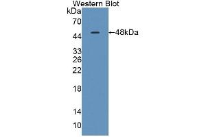 Detection of Recombinant TNNC1, Human using Polyclonal Antibody to Troponin C Type 1, Slow (TNNC1) (TNNC1 Antikörper  (AA 1-161))