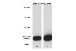 Perfused isolated rat heart whole tissue lysate was lysed with either A) 50 mM Tris-HCl, 150 mM NaCl, 1 mM EDTA, 1 % NP-40, 0. (ACO2 Antikörper  (AA 438-467))
