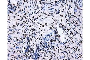 Immunohistochemical staining of paraffin-embedded Ovary tissue using anti-RALBP1mouse monoclonal antibody. (RALBP1 Antikörper)