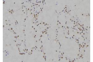 ABIN6274221 at 1/100 staining Human lung tissue by IHC-P. (MZF1 Antikörper  (N-Term))