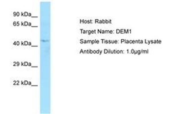 EXO5 antibody  (AA 202-251)