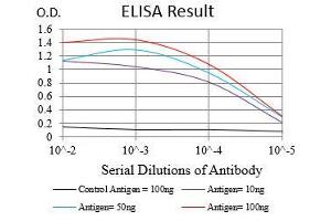 Black line: Control Antigen (100 ng), Purple line: Antigen(10 ng), Blue line: Antigen (50 ng), Red line: Antigen (100 ng), (ZEB1 Antikörper  (AA 967-1108))