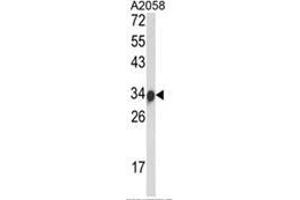 Western blot analysis of IGH Antibody (C-Term) in A2058 cell line lysates (35ug/lane).