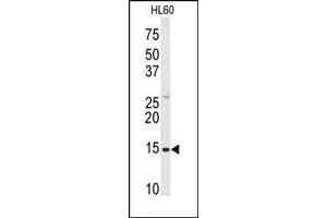 Image no. 1 for anti-SnRNP-D1 / Sm-D (Middle Region) antibody (ABIN358018) (SnRNP-D1 / Sm-D (Middle Region) Antikörper)