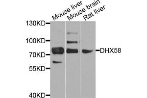 Western blot analysis of extracts of various cell lines, using DHX58 antibody (ABIN5974537) at 1/1000 dilution. (DHX58 Antikörper)