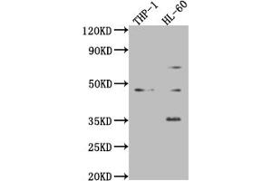 Western Blot Positive WB detected in: Mouse heart tissue, Mouse spleen tissue, Mouse lung tissue All lanes: ZKSCAN3 antibody at 4 μg/mL Secondary Goat polyclonal to rabbit IgG at 1/50000 dilution predicted band size: 61, 44 kDa observed band size: 61, 44 kDa (ZKSCAN3 Antikörper  (AA 8-275))