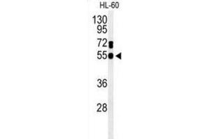 Western Blotting (WB) image for anti-Guanine Deaminase (GDA) antibody (ABIN3004286) (GDA Antikörper)