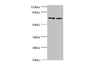 Western blot All lanes: Annexin A6 antibody at 4 μg/mL Lane 1: Jurkat whole cell lysate Lane 2: Hela whole cell lysate Secondary Goat polyclonal to rabbit IgG at 1/10000 dilution Predicted band size: 76, 73 kDa Observed band size: 76 kDa (ANXA6 Antikörper  (AA 1-250))
