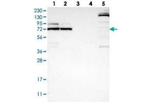 Western blot analysis of Lane 1: RT-4, Lane 2: U-251 MG, Lane 3: Human Plasma, Lane 4: Liver, Lane 5: Tonsil with METTL16 polyclonal antibody  at 1:250-1:500 dilution. (METTL16 Antikörper)