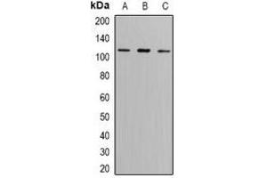 Western blot analysis of GLUR6 expression in SW620 (A), A549 (B), mouse brain (C) whole cell lysates. (GRIK2 Antikörper)