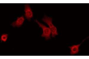 Immunofluorescence (fixed cells) (IF/ICC) image for anti-Prostaglandin Reductase 1 (PTGR1) (Internal Region) antibody (ABIN6257814)