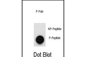 Dot blot analysis of anti-hp53- Phospho-specific Pab (ABIN389620 and ABIN2839624) on nitrocellulose membrane. (p53 Antikörper  (pSer315))