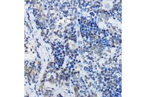 Immunohistochemistry of paraffin-embedded rat spleen using MYBBP1A Rabbit pAb (ABIN1680938, ABIN3018915, ABIN3018916 and ABIN6220628) at dilution of 1:100 (40x lens).