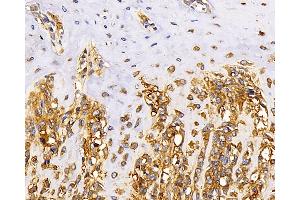 Immunohistochemistry analysis of paraffin-embedded rat bone using MAGEC1 Polyclonal Antibody at dilution of 1:300. (MAGEC1 Antikörper)