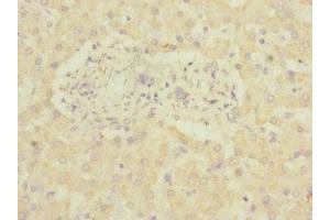 Immunohistochemistry of paraffin-embedded human liver tissue using ABIN7143403 at dilution of 1:100 (Adhesion G-Protein Coupled Receptor G6 (ADGRG6) (AA 40-300) Antikörper)