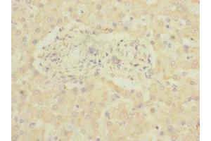 Immunohistochemistry of paraffin-embedded human liver tissue using ABIN7143403 at dilution of 1:100 (ADGRG6 (AA 40-300) Antikörper)