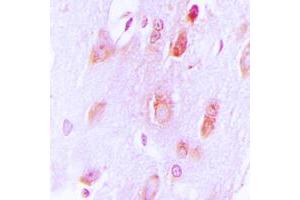 Immunohistochemical analysis of Tyrosine Hydroxylase staining in human brain formalin fixed paraffin embedded tissue section. (Tyrosine Hydroxylase Antikörper  (N-Term))