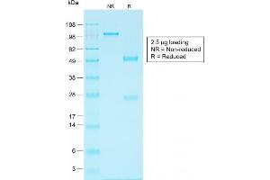 SDS-PAGE Analysis Purified EpCAM Rabbit Recombinant Monoclonal Antibody (EGP40/1556R). (Rekombinanter EpCAM Antikörper)