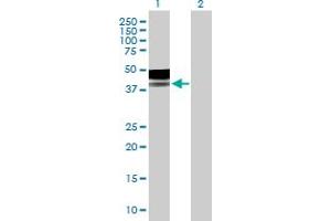 Western Blot analysis of PLA2G15 expression in transfected 293T cell line by PLA2G15 MaxPab polyclonal antibody. (PLA2G15 Antikörper  (AA 1-412))