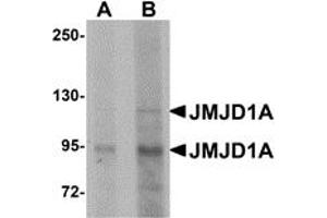 Western Blotting (WB) image for anti-Lysine (K)-Specific Demethylase 3A (KDM3A) (N-Term) antibody (ABIN1031423)