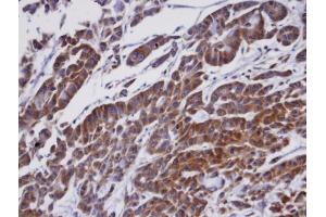 IHC-P Image Immunohistochemical analysis of paraffin-embedded A549 xenograft, using ORP1, antibody at 1:100 dilution. (OSBPL1A Antikörper  (C-Term))
