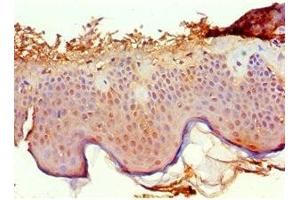 Immunohistochemistry of paraffin-embedded human skin tissue using ABIN7167500 at dilution of 1:100 (PTPRA Antikörper  (AA 20-142))