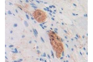 Immunohistochemistry (IHC) image for anti-C-Type Lectin Domain Family 4, Member M (CLEC4M) (AA 242-399) antibody (ABIN7441907)