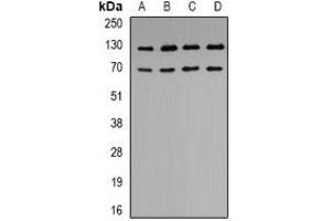 Western blot analysis of K Cadherin expression in BT474 (A), A549 (B), SHSY5Y (C), HEK293T (D) whole cell lysates. (CDH6 Antikörper)