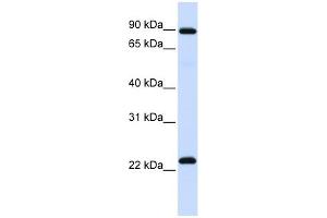 RGS19 antibody used at 1 ug/ml to detect target protein.