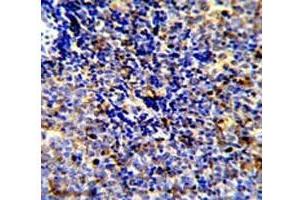 Immunohistochemistry (IHC) image for anti-C-Mer Proto-Oncogene Tyrosine Kinase (MERTK) antibody (ABIN3030229)