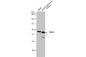 WB Image A549 whole cell and membrane extracts (30 μg) were separated by 7. (TRPC6 Antikörper  (C-Term))