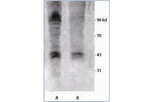 Image no. 1 for anti-Phosphothreonine antibody (ABIN264877) (Phosphothreonine Antikörper)
