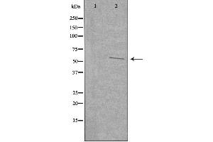 Western blot analysis of extracts from COLO cells, using UGDH antibody. (UGDH Antikörper  (C-Term))