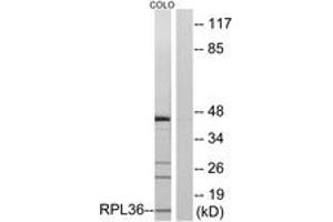 Western blot analysis of extracts from COLO cells, using RPL36 Antibody.