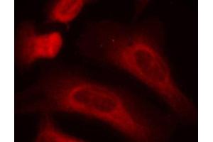 Immunofluorescence staining of methanol-fixed Hela cells, using Phospho-STAT1-S727 antibody.