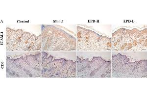 EPD inhibited inflammatory cell infiltration in IMQ-induced psoriasis-like mouse mode. (ICAM1 Antikörper  (AA 201-300))