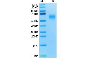 SDS-PAGE (SDS) image for CD200 Receptor 1 (CD200R1) (AA 26-238) protein (His tag) (ABIN7274124)
