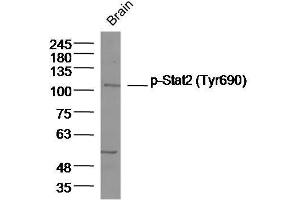 Western Blotting (WB) image for anti-Signal Transducer and Activator of Transcription 2, 113kDa (STAT2) (pTyr690) antibody (ABIN746183)