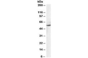 Western blot testing of human ovay lysate with PTBP1 antibody at 0. (PTBP1 Antikörper)
