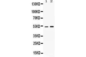 Western blot analysis of SERPINA1 expression in rat brain extract ( Lane 1) and HELA whole cell lysates ( Lane 2).