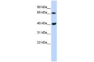 WB Suggested Anti-CCND1 Antibody Titration:  0. (Cyclin D1 Antikörper  (N-Term))