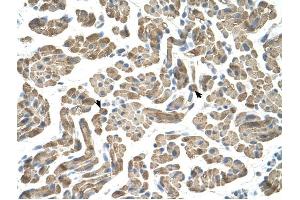 NEU1 antibody was used for immunohistochemistry at a concentration of 4-8 ug/ml to stain Skeletal muscle cells (arrows) in Human Muscle. (NEU1 Antikörper)