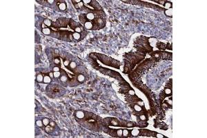 Immunohistochemical staining of human duodenum shows strong cytoplasmic and membranous positivity in glandular cells. (WNT8A Antikörper)
