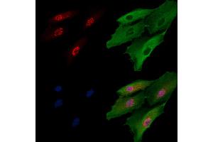 ABIN7094653 and ABIN7098704 staining  cells by IF/ICC.