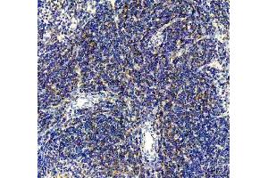 IHC analysis of CD80 using anti-CD80 antibody (ABIN5692796).