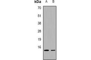 Western blot analysis of FABP2 expression in K562 (A), mouse lung (B) whole cell lysates. (FABP2 Antikörper  (C-Term))
