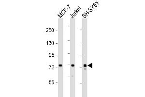 All lanes : Anti-KIF22 Antibody (Center) at 1:2000 dilution Lane 1: MCF-7 whole cell lysates Lane 2: Jurkat whole cell lysates Lane 3: SH-SY5Y whole cell lysates Lysates/proteins at 20 μg per lane. (KIF22 Antikörper  (AA 423-456))