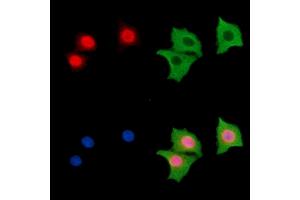 ABIN7096643 and ABIN7100708 staining HepG2 cells by IF/ICC. (Forkhead Box J2 Antikörper)