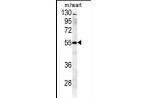 B4GALT5 Antibody (C-term) (ABIN651558 and ABIN2840299) western blot analysis in mouse heart tissue lysates (35 μg/lane).